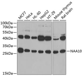 Western Blot - Anti-ARD1A Antibody (A15482) - Antibodies.com