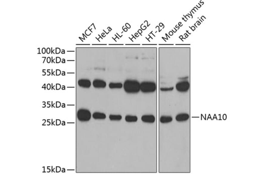 Western Blot - Anti-ARD1A Antibody (A15482) - Antibodies.com