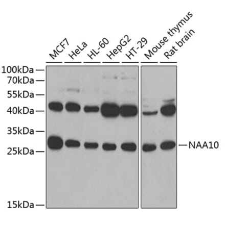Western Blot - Anti-ARD1A Antibody (A15482) - Antibodies.com