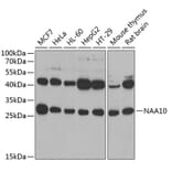 Western Blot - Anti-ARD1A Antibody (A15482) - Antibodies.com
