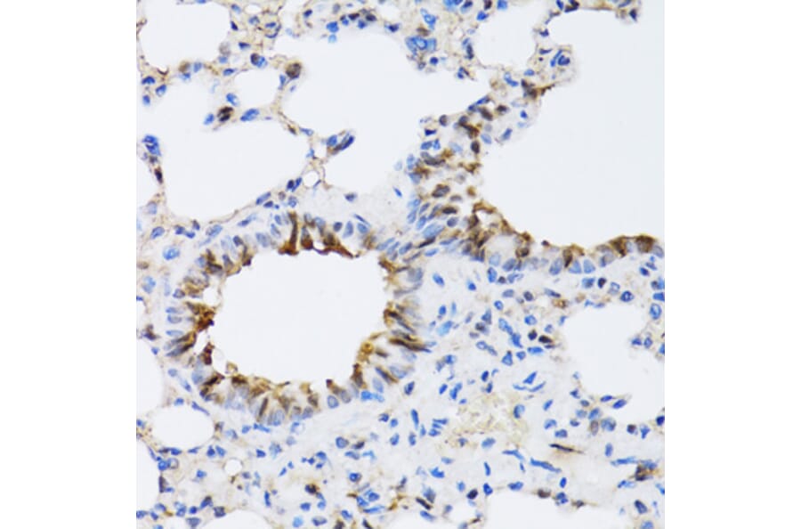 Immunohistochemistry - Anti-ARD1A Antibody (A15482) - Antibodies.com