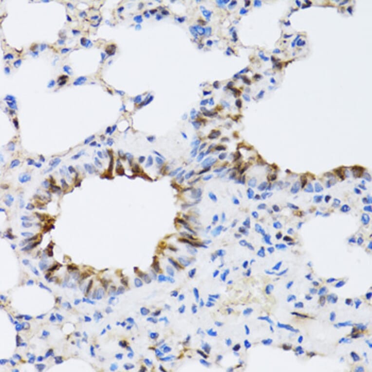 Immunohistochemistry - Anti-ARD1A Antibody (A15482) - Antibodies.com
