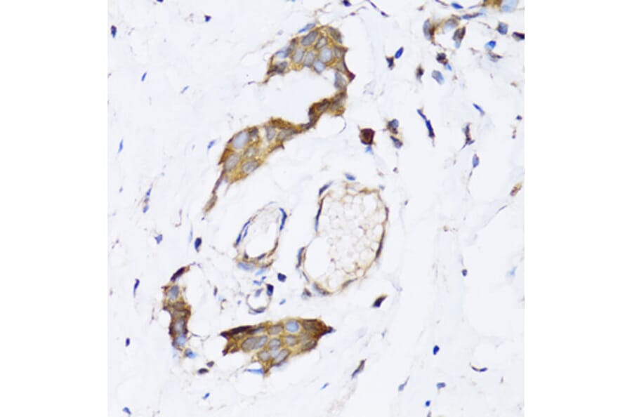 Immunohistochemistry - Anti-ARD1A Antibody (A15482) - Antibodies.com