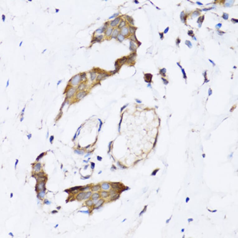 Immunohistochemistry - Anti-ARD1A Antibody (A15482) - Antibodies.com