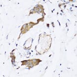 Immunohistochemistry - Anti-ARD1A Antibody (A15482) - Antibodies.com