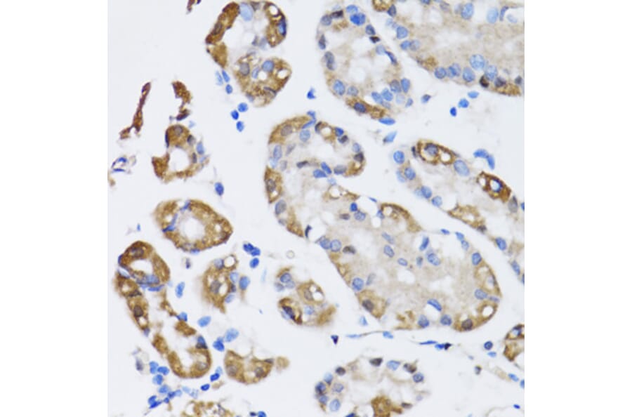 Immunohistochemistry - Anti-ARD1A Antibody (A15482) - Antibodies.com
