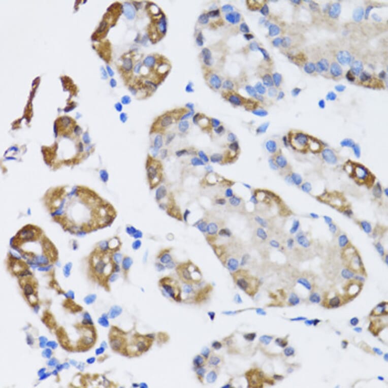 Immunohistochemistry - Anti-ARD1A Antibody (A15482) - Antibodies.com