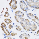 Immunohistochemistry - Anti-ARD1A Antibody (A15482) - Antibodies.com