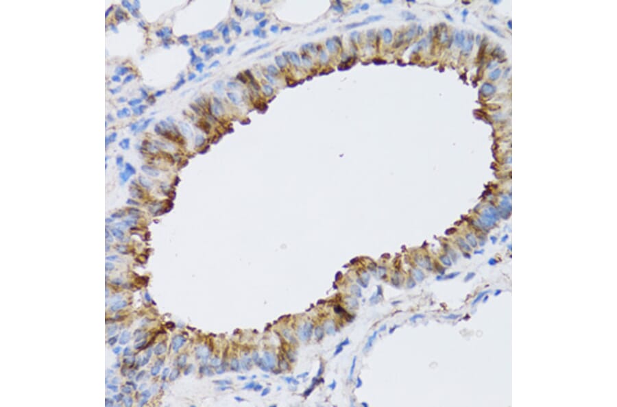Immunohistochemistry - Anti-ARD1A Antibody (A15482) - Antibodies.com