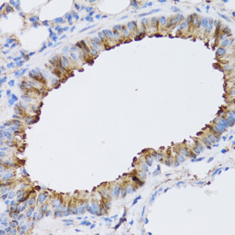 Immunohistochemistry - Anti-ARD1A Antibody (A15482) - Antibodies.com