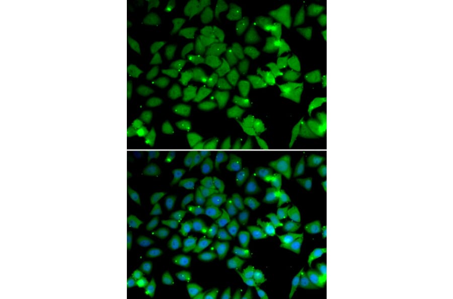 Immunofluorescence - Anti-ARD1A Antibody (A15482) - Antibodies.com