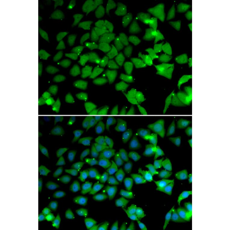 Immunofluorescence - Anti-ARD1A Antibody (A15482) - Antibodies.com