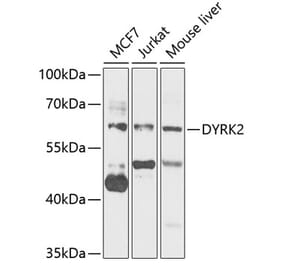 Western Blot - Anti-DYRK2 Antibody (A15484) - Antibodies.com