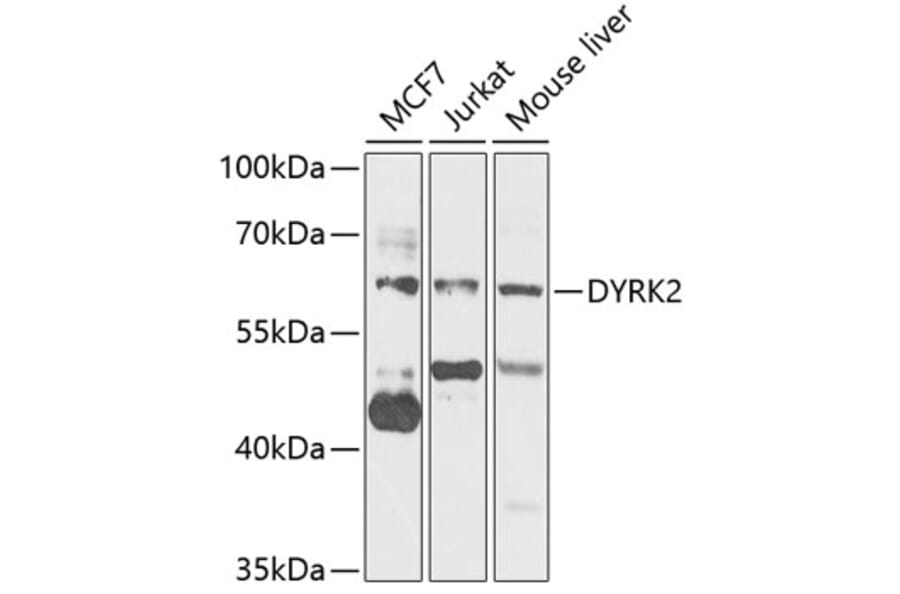 Western Blot - Anti-DYRK2 Antibody (A15484) - Antibodies.com