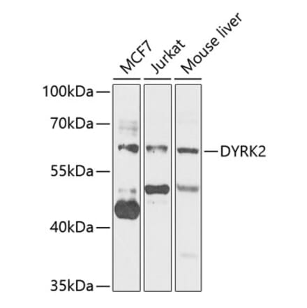 Western Blot - Anti-DYRK2 Antibody (A15484) - Antibodies.com