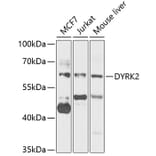 Western Blot - Anti-DYRK2 Antibody (A15484) - Antibodies.com