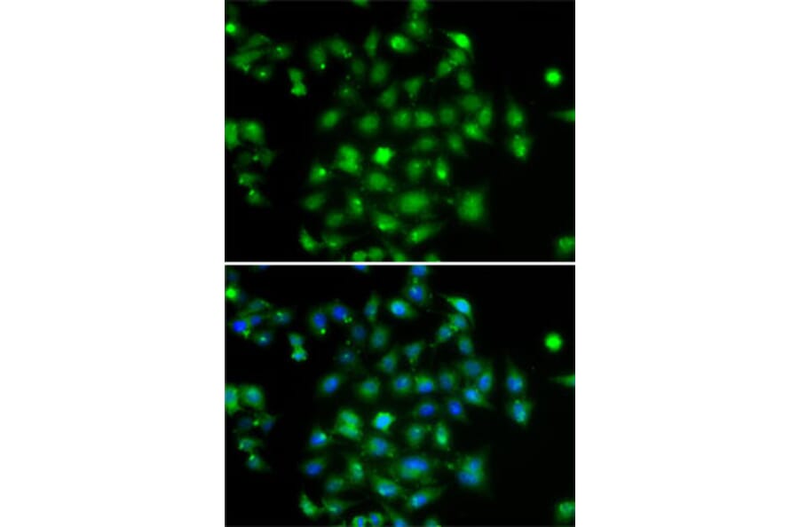 Immunofluorescence - Anti-DYRK2 Antibody (A15484) - Antibodies.com