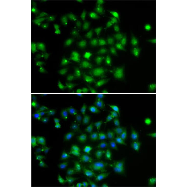 Immunofluorescence - Anti-DYRK2 Antibody (A15484) - Antibodies.com