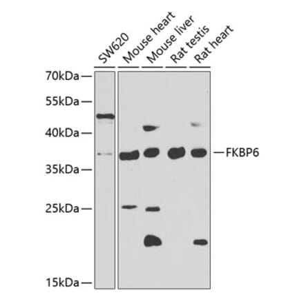 Western Blot - Anti-FKBP6 Antibody (A15485) - Antibodies.com