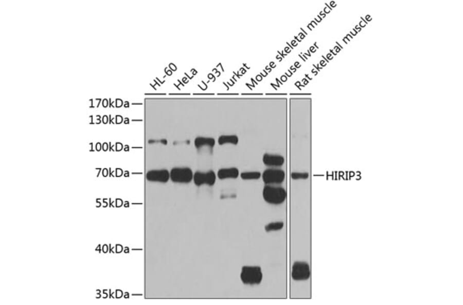 Western Blot - Anti-HIRIP3 Antibody (A15486) - Antibodies.com