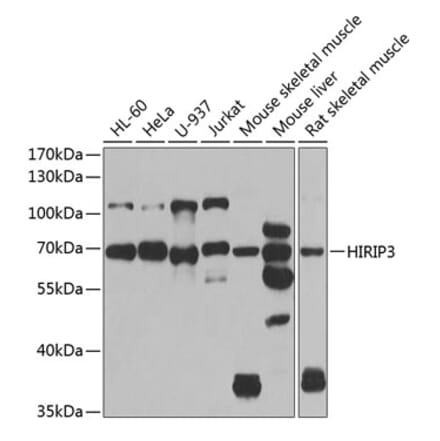 Western Blot - Anti-HIRIP3 Antibody (A15486) - Antibodies.com