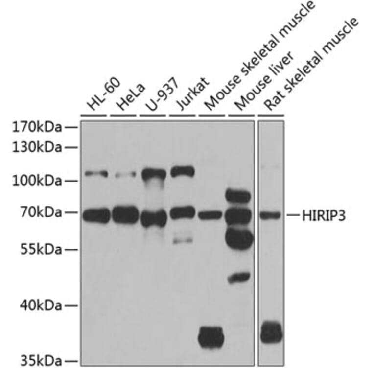 Western Blot - Anti-HIRIP3 Antibody (A15486) - Antibodies.com