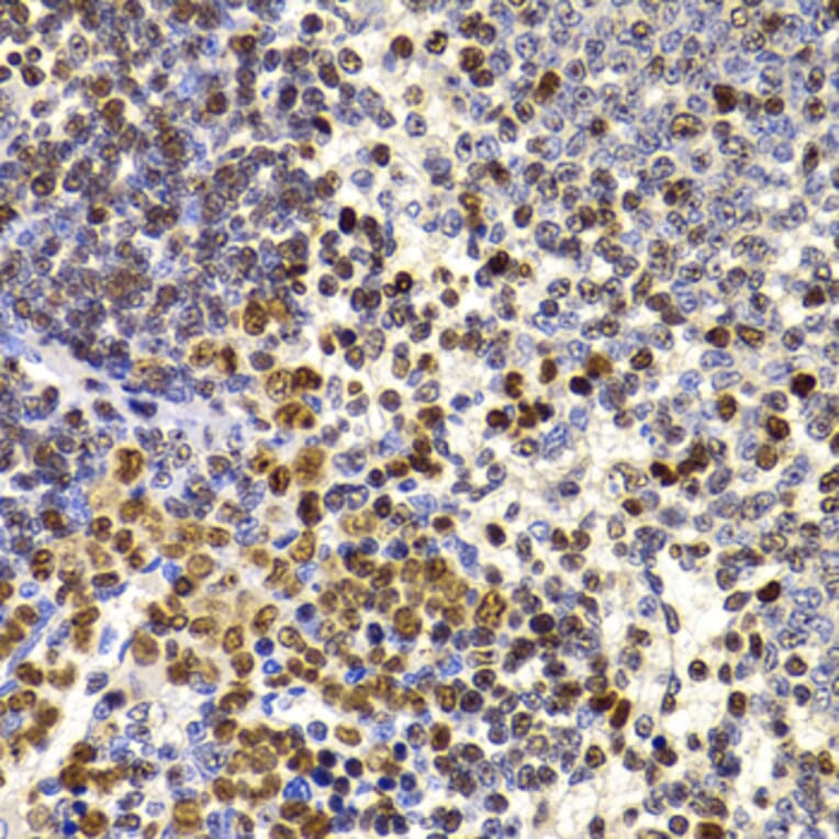 Immunohistochemistry - Anti-HIRIP3 Antibody (A15486) - Antibodies.com