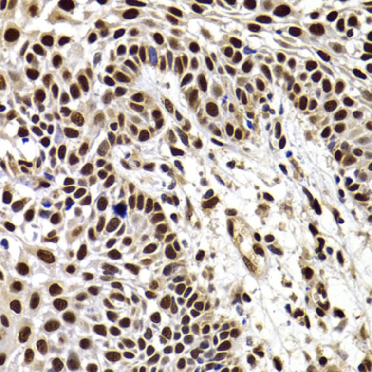 Immunohistochemistry - Anti-HIRIP3 Antibody (A15486) - Antibodies.com