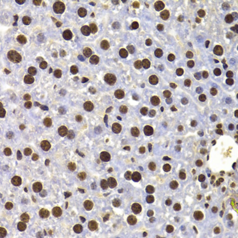 Immunohistochemistry - Anti-HIRIP3 Antibody (A15486) - Antibodies.com