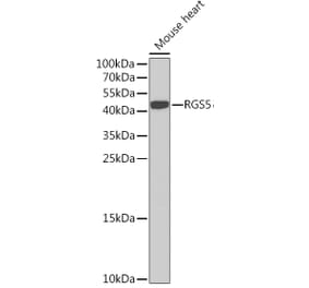 Western Blot - Anti-RGS5 Antibody (A15487) - Antibodies.com