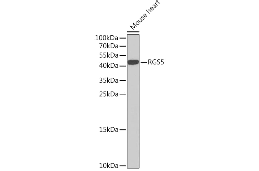Western Blot - Anti-RGS5 Antibody (A15487) - Antibodies.com