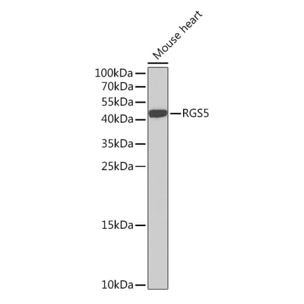 Western Blot - Anti-RGS5 Antibody (A15487) - Antibodies.com