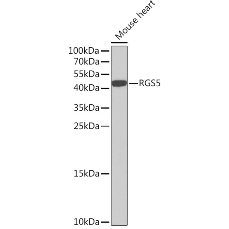 Western Blot - Anti-RGS5 Antibody (A15487) - Antibodies.com