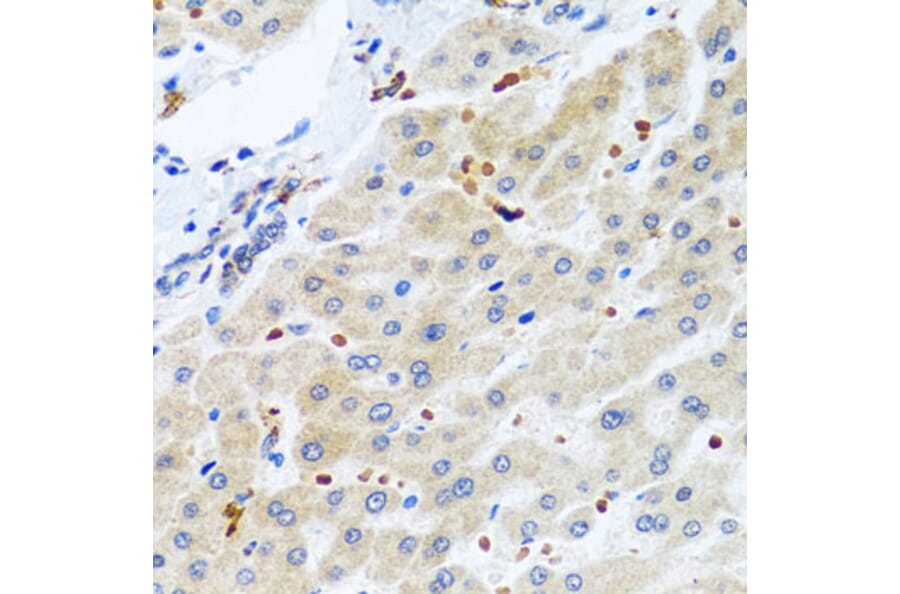 Immunohistochemistry - Anti-RGS5 Antibody (A15487) - Antibodies.com