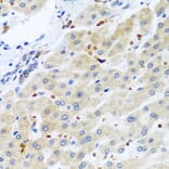 Immunohistochemistry - Anti-RGS5 Antibody (A15487) - Antibodies.com