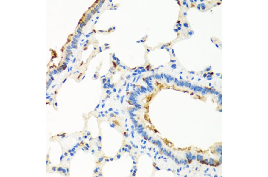 Immunohistochemistry - Anti-RGS5 Antibody (A15487) - Antibodies.com