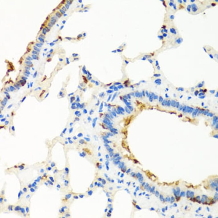 Immunohistochemistry - Anti-RGS5 Antibody (A15487) - Antibodies.com