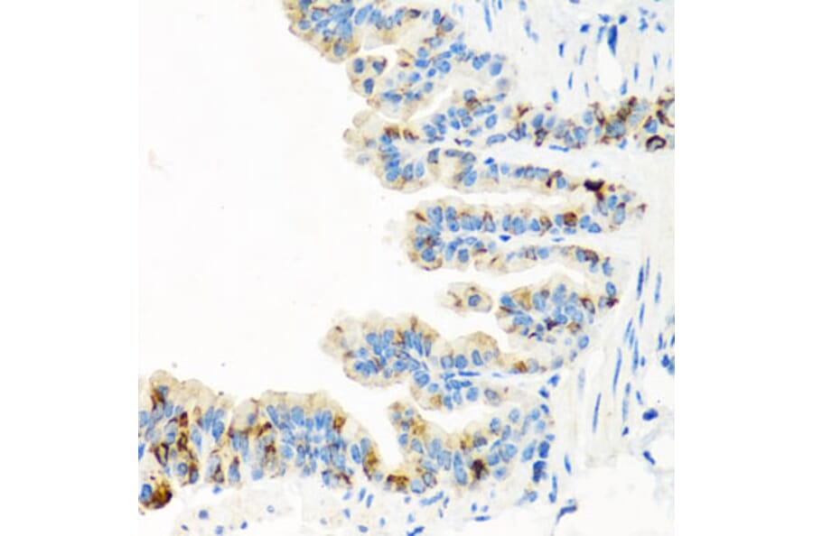 Immunohistochemistry - Anti-RGS5 Antibody (A15487) - Antibodies.com