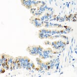 Immunohistochemistry - Anti-RGS5 Antibody (A15487) - Antibodies.com