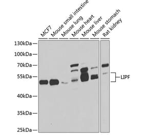 Western Blot - Anti-LIPF Antibody (A7016) - Antibodies.com
