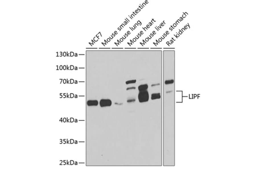 Western Blot - Anti-LIPF Antibody (A7016) - Antibodies.com