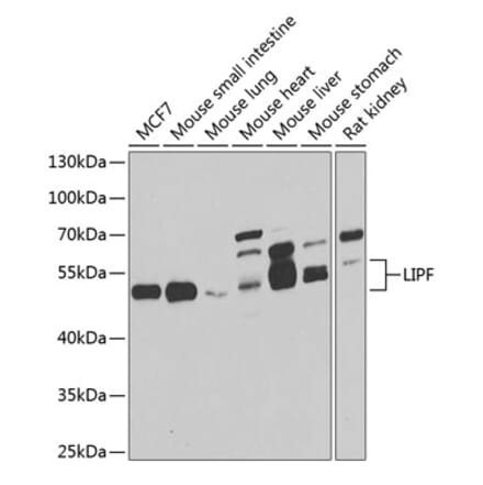 Western Blot - Anti-LIPF Antibody (A15488) - Antibodies.com