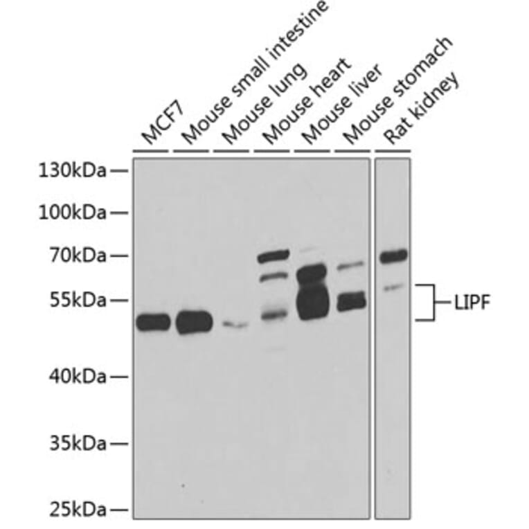 Western Blot - Anti-LIPF Antibody (A7016) - Antibodies.com