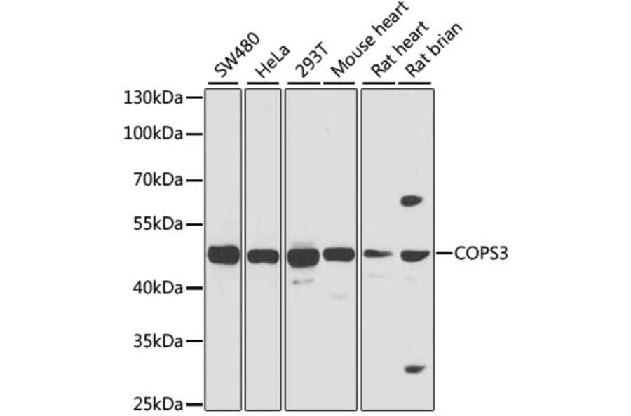 Western Blot - Anti-COPS3/CSN3 Antibody (A15489) - Antibodies.com
