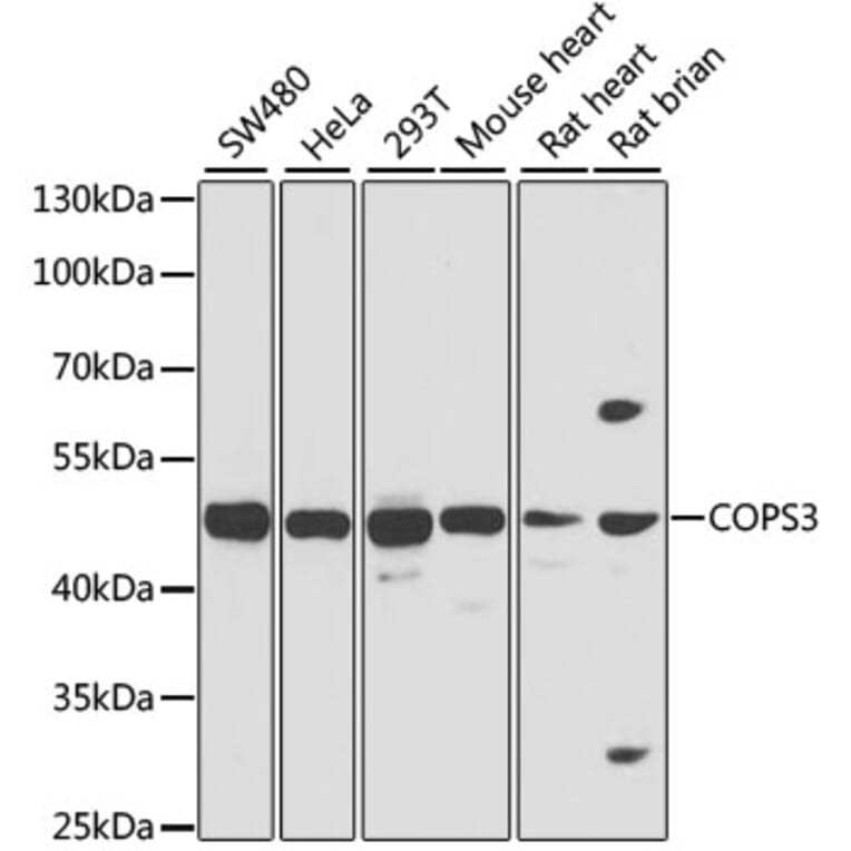 Western Blot - Anti-COPS3/CSN3 Antibody (A15489) - Antibodies.com