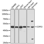 Western Blot - Anti-COPS3/CSN3 Antibody (A15489) - Antibodies.com