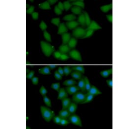 Immunofluorescence - Anti-CAMK1 Antibody (A7018) - Antibodies.com