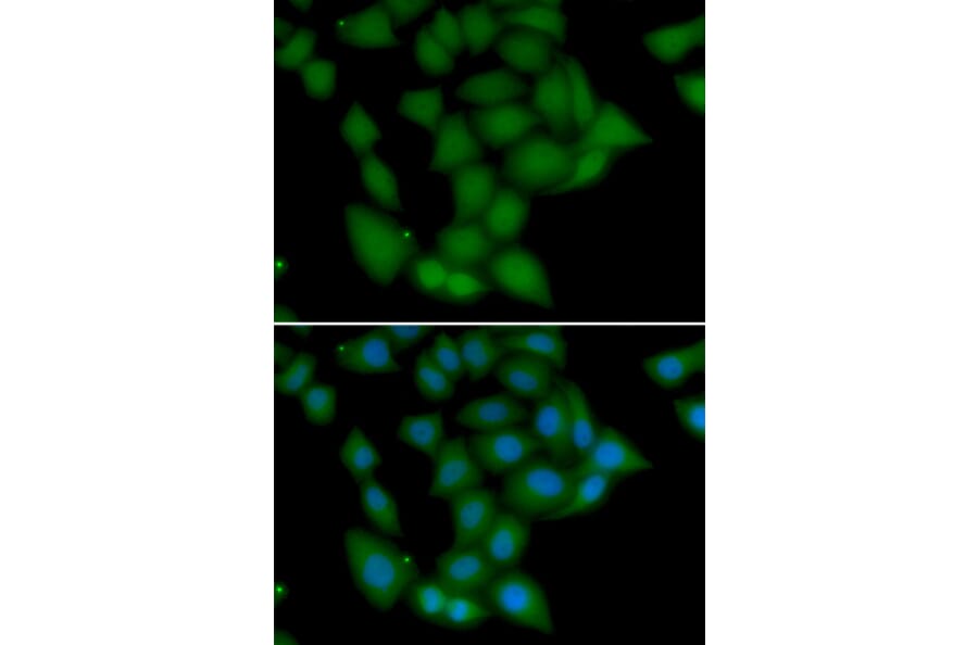 Immunofluorescence - Anti-CAMK1 Antibody (A7018) - Antibodies.com