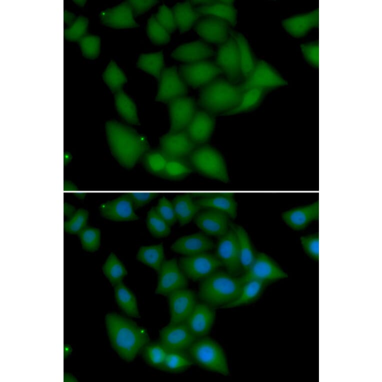 Immunofluorescence - Anti-CAMK1 Antibody (A7018) - Antibodies.com