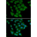 Immunofluorescence - Anti-CAMK1 Antibody (A7018) - Antibodies.com